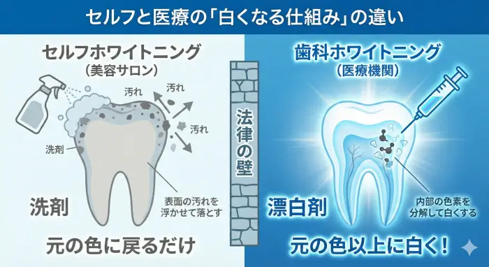 セルフと医療の「白くなる仕組み」の違い