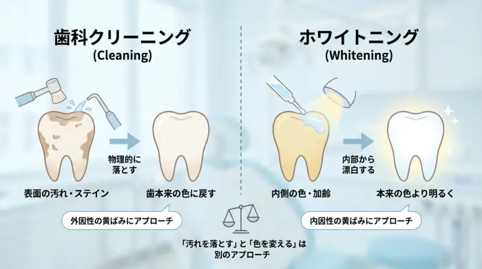 ホワイトニングは3ルート。あなたに合うのはどれ？