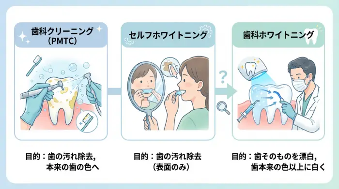 【3分で理解】クリーニング、セルフ、歯科ホワイトニング。何が違うの？