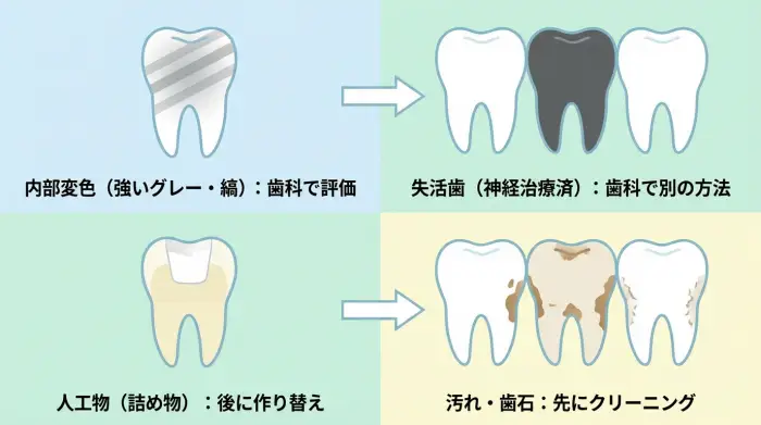 ホワイトニングで「白くならない人」の典型パターン