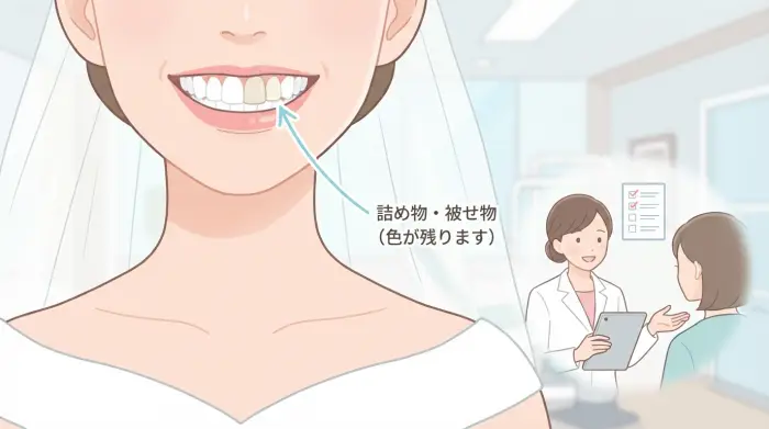 【落とし穴】「詰め物・被せ物は白くならない」…当日バレやすいのはここ