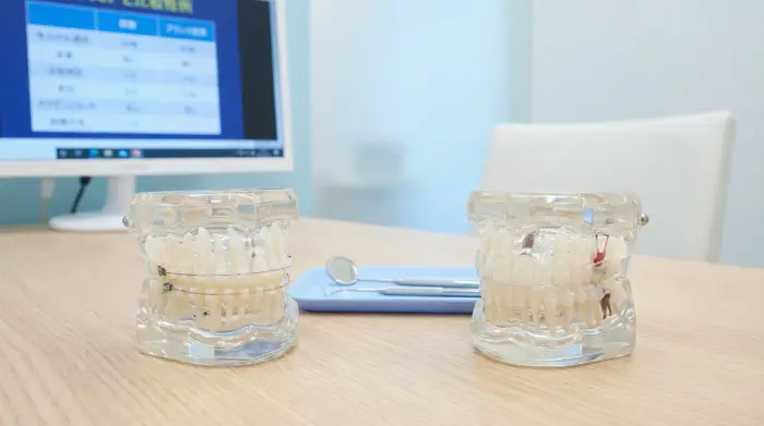 ワイヤー?マウスピース?あなたに合う治療法の見つけ方【徹底比較】