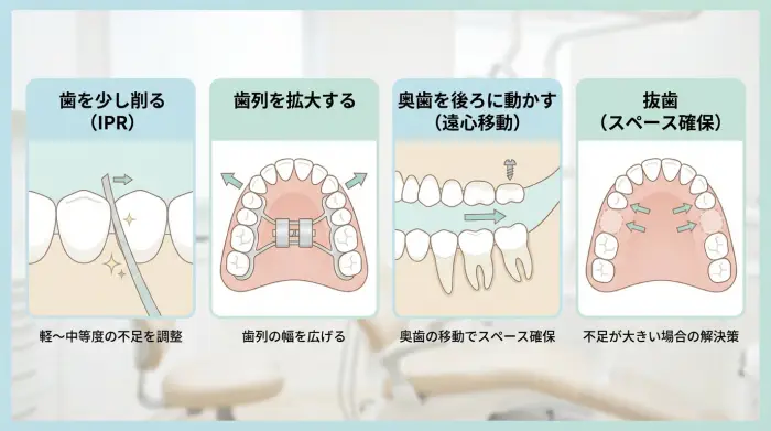 抜歯・非抜歯で迷わないための判断軸：スペース確保の4手段