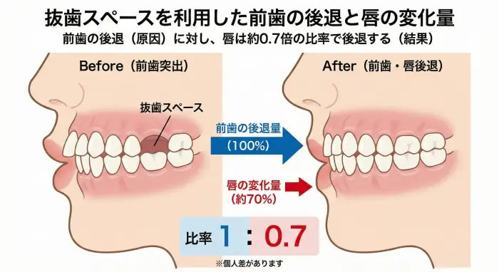 抜歯スペースを利用した前歯の後退と唇の変化量の関係図。前歯の後退という原因に対し、唇が約0.7倍の比率で後退する結果を可視化