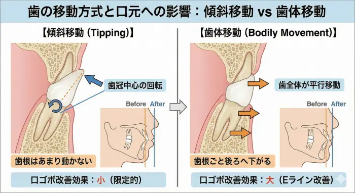 「治らなかった……」口ゴボ矯正で横顔が変わらなかった3つの医学的理由と再治療の進め方