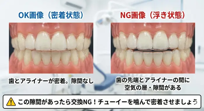 マウスピース矯正の適合状態チェック画像。左側はアライナーが歯に密着している正常な状態、右側はアライナーと歯の間に隙間(浮き)がある異常な状態。