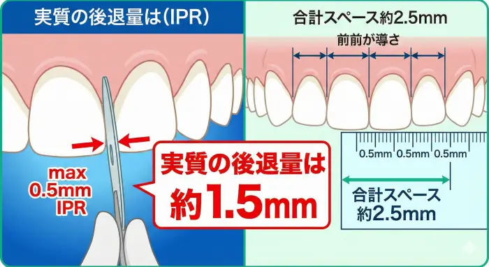 IPRで確保できるスペースの限界値は約2.5mm、実質後退量は約1.5mmであることを示す図解