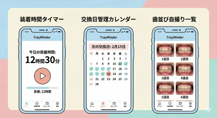 矯正管理アプリTrayMinderの3つの主要機能画面。